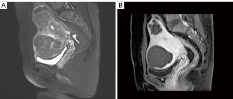 https://cdn.ncbi.nlm.nih.gov/pmc/blobs/46b8/11994487/9a9b5f6dfff6/qims-15-04-3084-f2.jpg