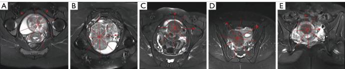 https://cdn.ncbi.nlm.nih.gov/pmc/blobs/46b8/11994487/f03bf3480d9d/qims-15-04-3084-f1.jpg