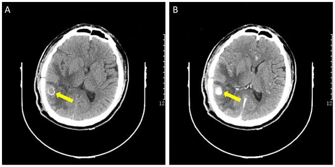 https://cdn.ncbi.nlm.nih.gov/pmc/blobs/46ba/9716116/56a860634226/etm-24-06-11676-g04.jpg