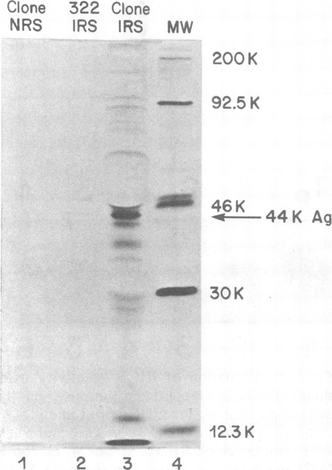https://cdn.ncbi.nlm.nih.gov/pmc/blobs/46c2/264449/19c8d9311cb1/iai00134-0016-a.jpg