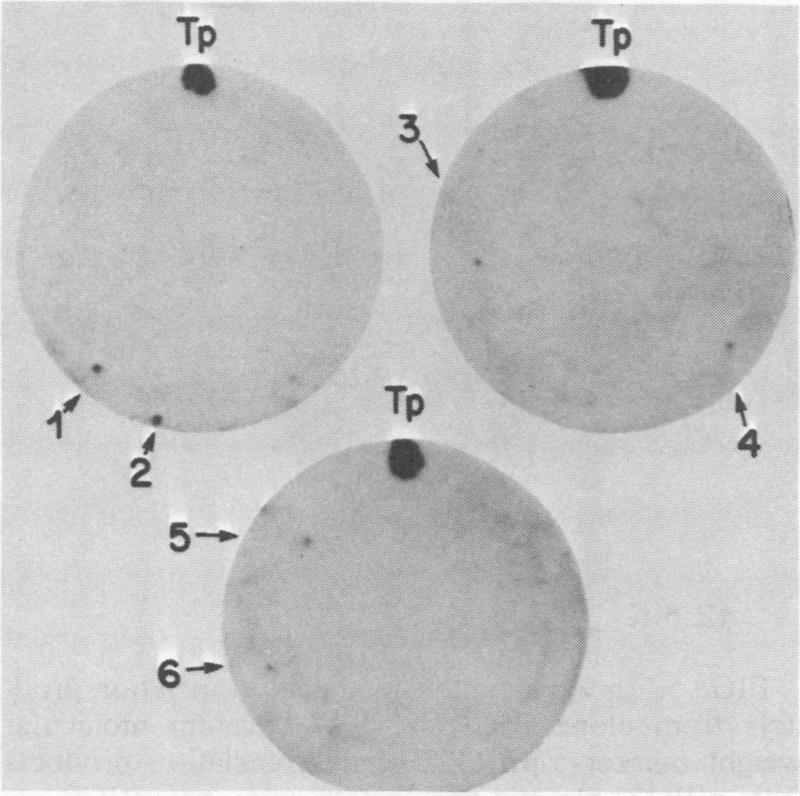 https://cdn.ncbi.nlm.nih.gov/pmc/blobs/46c2/264449/21eaf09815ca/iai00134-0015-b.jpg