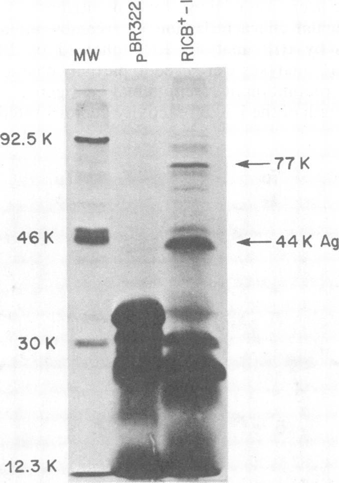 https://cdn.ncbi.nlm.nih.gov/pmc/blobs/46c2/264449/dcb018ad2cbe/iai00134-0016-b.jpg