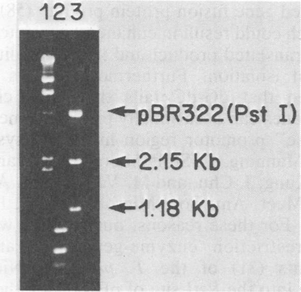https://cdn.ncbi.nlm.nih.gov/pmc/blobs/46c2/264449/fd340ed96699/iai00134-0017-a.jpg