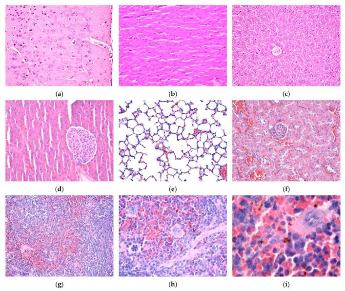 https://cdn.ncbi.nlm.nih.gov/pmc/blobs/46c5/12073745/a563f9657d96/nanomaterials-15-00637-g011.jpg