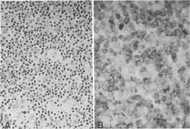 https://cdn.ncbi.nlm.nih.gov/pmc/blobs/46c5/1880587/3c5f1db2dc8d/amjpathol00134-0165-a.jpg