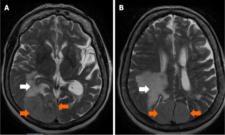 https://cdn.ncbi.nlm.nih.gov/pmc/blobs/46cc/12243921/8f4a482db306/wjcc-13-25-108429-g002.jpg