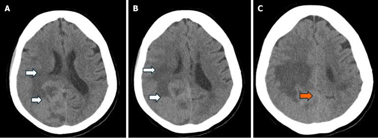 https://cdn.ncbi.nlm.nih.gov/pmc/blobs/46cc/12243921/976aabb39a43/wjcc-13-25-108429-g001.jpg