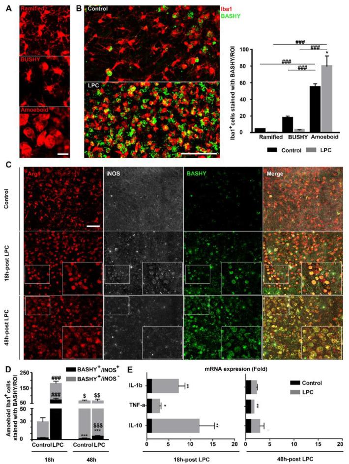 https://cdn.ncbi.nlm.nih.gov/pmc/blobs/46db/8620345/58024790dfb5/cells-10-03163-g003.jpg