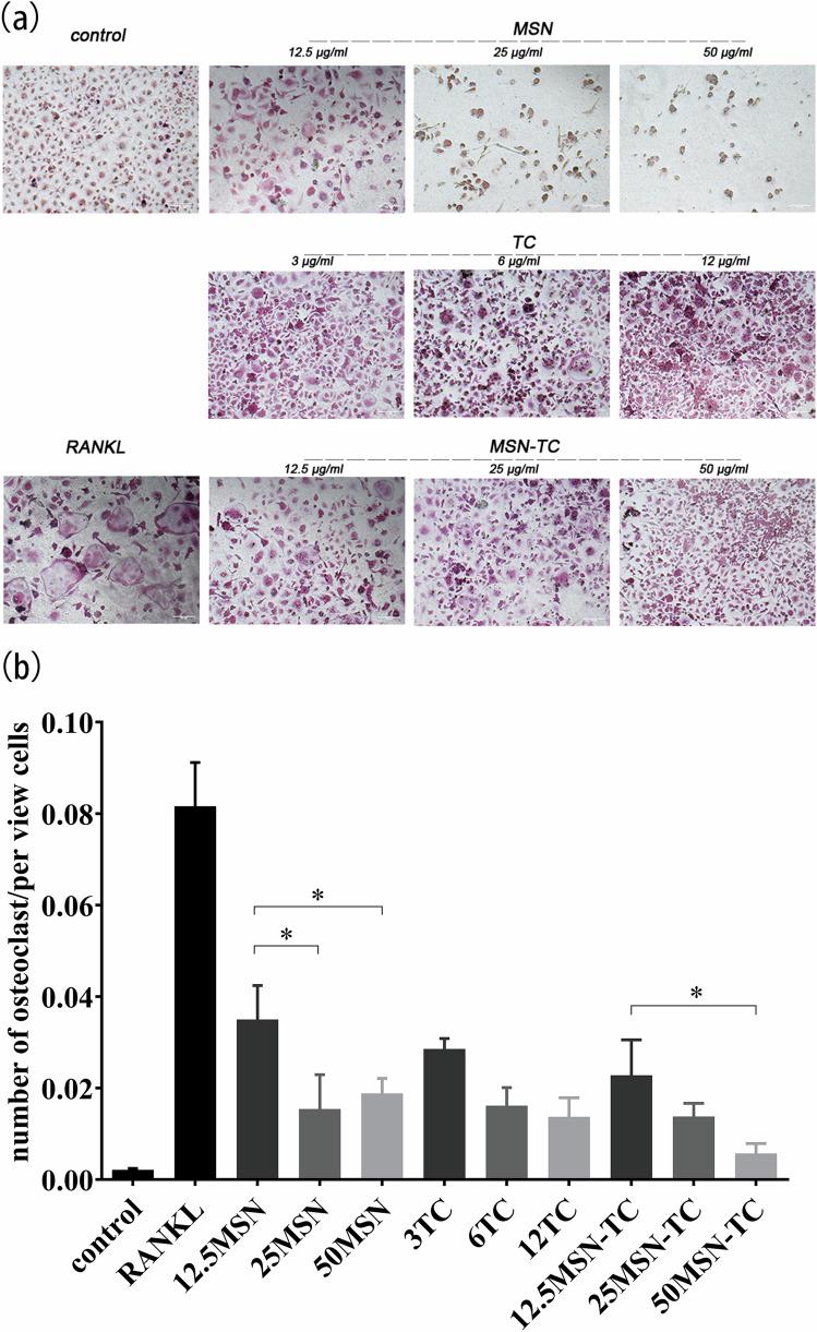 https://cdn.ncbi.nlm.nih.gov/pmc/blobs/46df/11442573/27d0b6986cc1/10856_2024_6827_Fig3_HTML.jpg