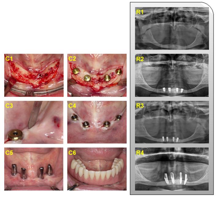 https://cdn.ncbi.nlm.nih.gov/pmc/blobs/46df/8910966/cbc62546f840/jcm-11-01367-g002.jpg