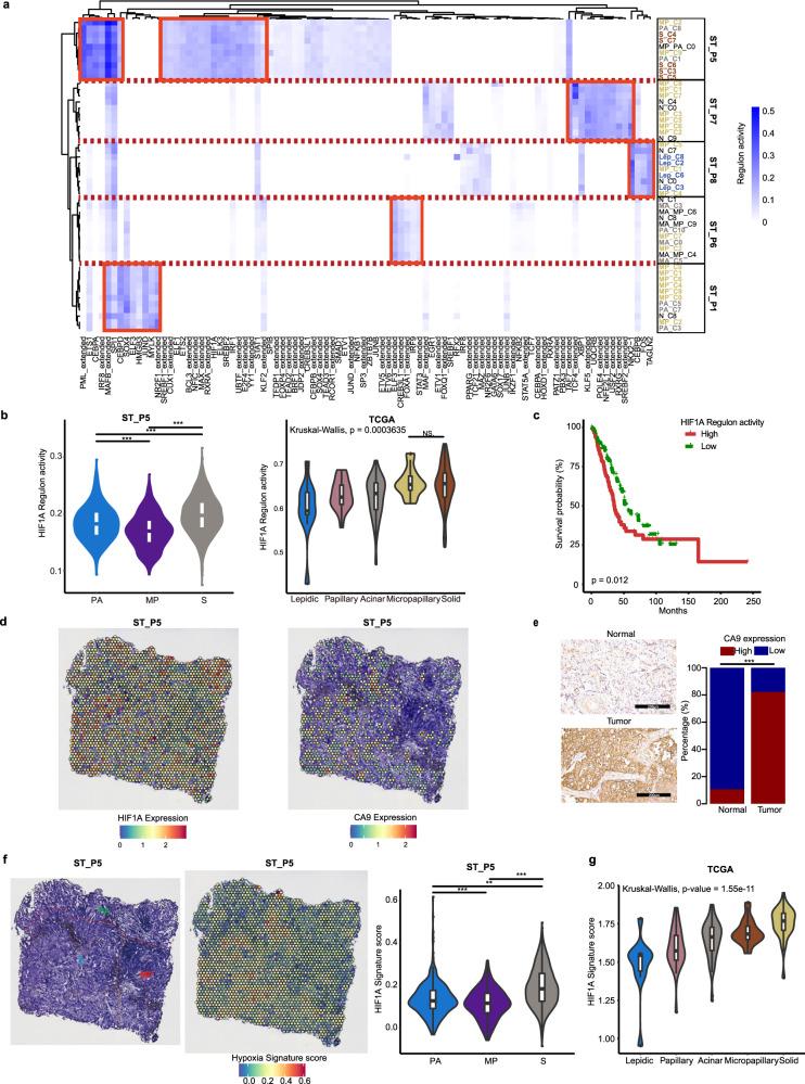 https://cdn.ncbi.nlm.nih.gov/pmc/blobs/46e2/10507052/aba2b4e15c79/41421_2023_591_Fig3_HTML.jpg