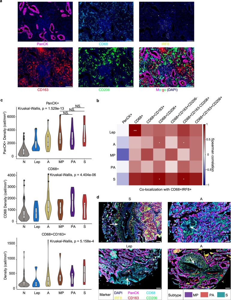 https://cdn.ncbi.nlm.nih.gov/pmc/blobs/46e2/10507052/debde695105f/41421_2023_591_Fig7_HTML.jpg