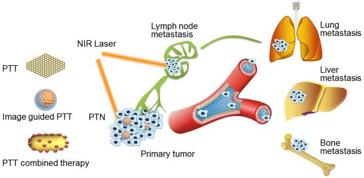 https://cdn.ncbi.nlm.nih.gov/pmc/blobs/46e2/4860886/68560332c7c0/thnov06p0762g001.jpg