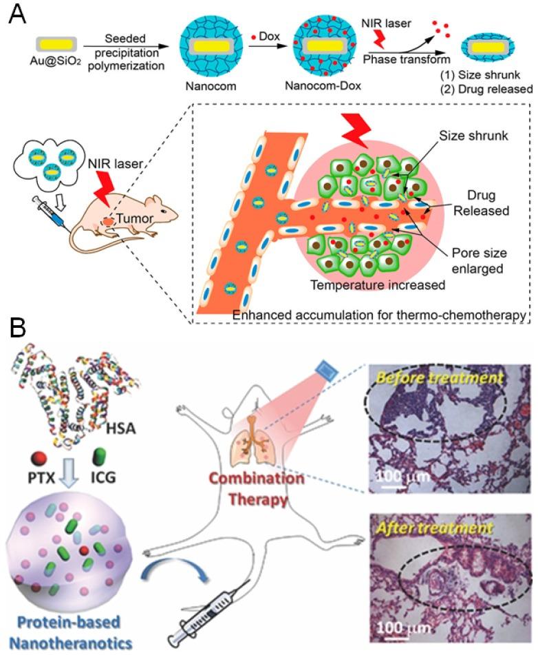 https://cdn.ncbi.nlm.nih.gov/pmc/blobs/46e2/4860886/b66055497ad6/thnov06p0762g005.jpg