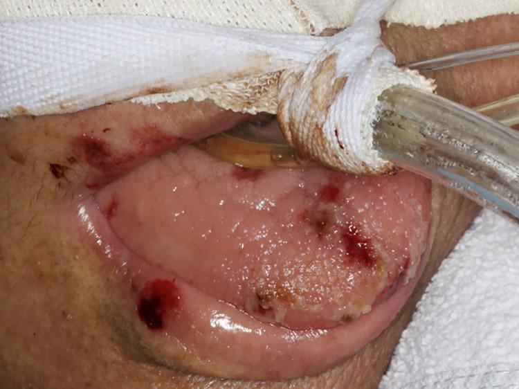 https://cdn.ncbi.nlm.nih.gov/pmc/blobs/46e3/7434495/43cf65050cc1/gr2_lrg.jpg
