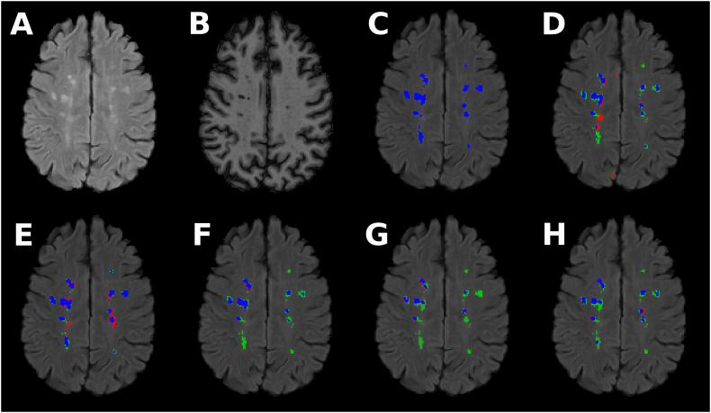 https://cdn.ncbi.nlm.nih.gov/pmc/blobs/46eb/6413299/2f1e43ecf075/gr4.jpg