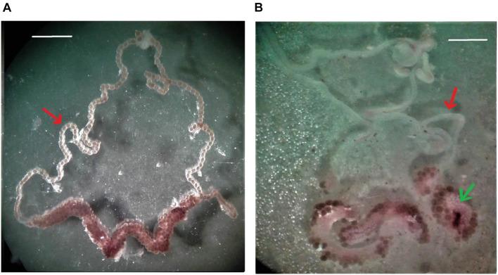 https://cdn.ncbi.nlm.nih.gov/pmc/blobs/46eb/8674642/2250ad35447d/fphys-12-768522-g003.jpg