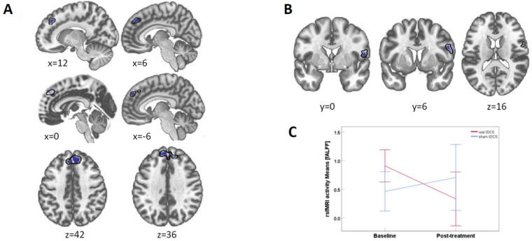 https://cdn.ncbi.nlm.nih.gov/pmc/blobs/46ed/9599056/f6ea3cee19f2/brainsci-12-01382-g003.jpg