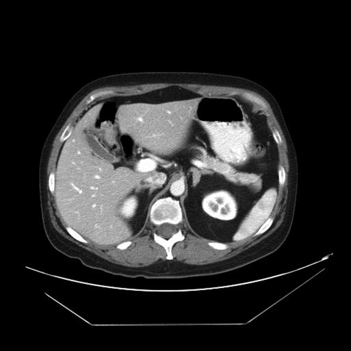 https://cdn.ncbi.nlm.nih.gov/pmc/blobs/46f0/3016181/f4fea3697cc2/jsls-12-2-198-g01.jpg
