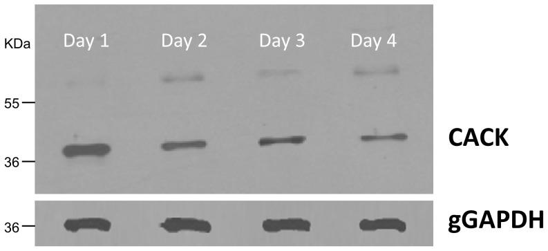 https://cdn.ncbi.nlm.nih.gov/pmc/blobs/46f0/4263474/379965c80ad6/pone.0113837.g004.jpg