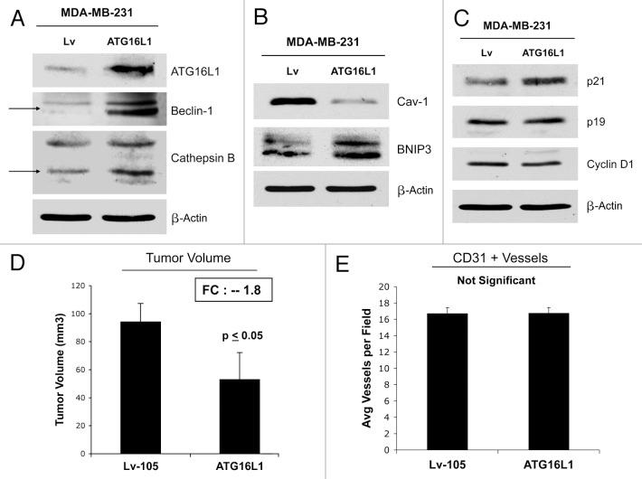 https://cdn.ncbi.nlm.nih.gov/pmc/blobs/46f3/3383590/62e27938ed97/cc-11-2285-g14.jpg