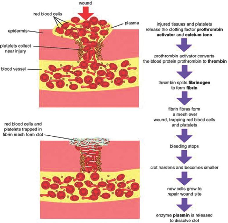 https://cdn.ncbi.nlm.nih.gov/pmc/blobs/46f4/5682705/261dfafdffec/JISPCD-7-55-g001.jpg