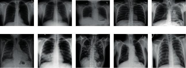 https://cdn.ncbi.nlm.nih.gov/pmc/blobs/46f8/7665931/44c3a898b3d5/RRP2020-8861206.001.jpg