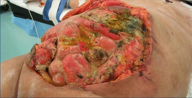 https://cdn.ncbi.nlm.nih.gov/pmc/blobs/46fa/8308068/3aca264bed27/68_2021_1750_Fig2_HTML.jpg