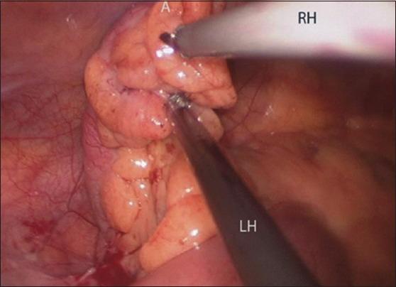 https://cdn.ncbi.nlm.nih.gov/pmc/blobs/4705/3889013/37d44d792fda/JSTCR-5-8-g004.jpg