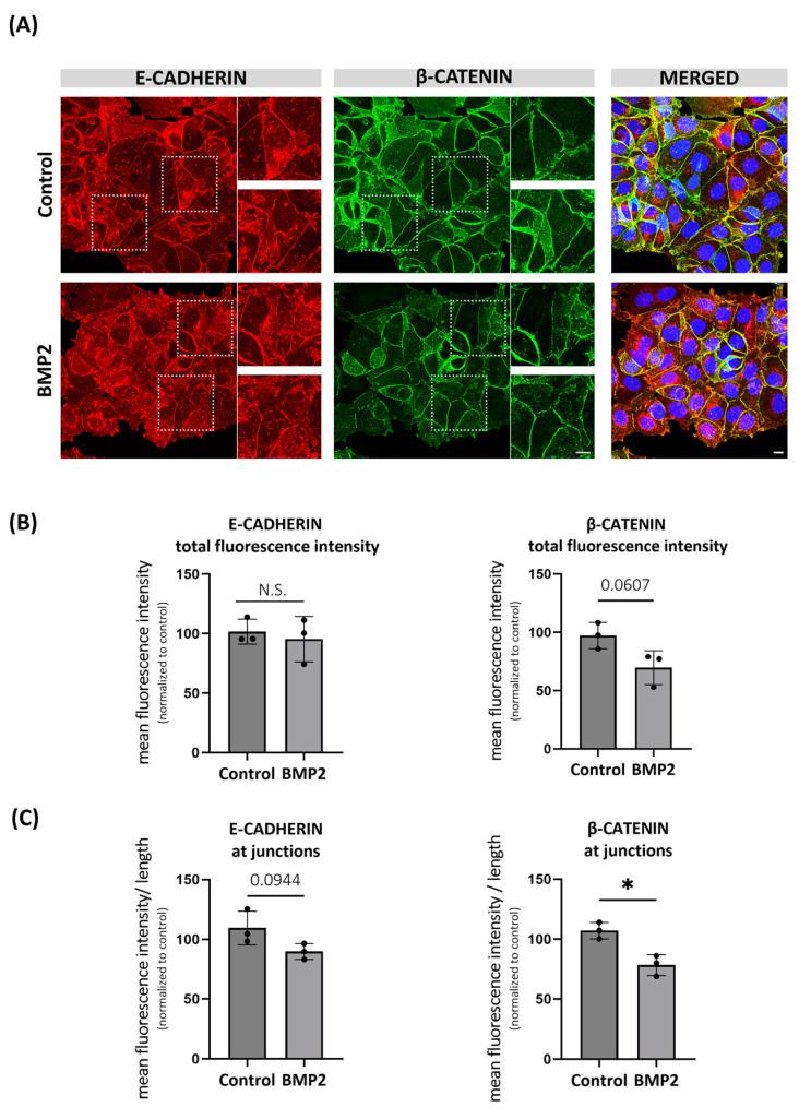 https://cdn.ncbi.nlm.nih.gov/pmc/blobs/4707/11083028/01f8086488bb/ijms-25-04593-g004.jpg