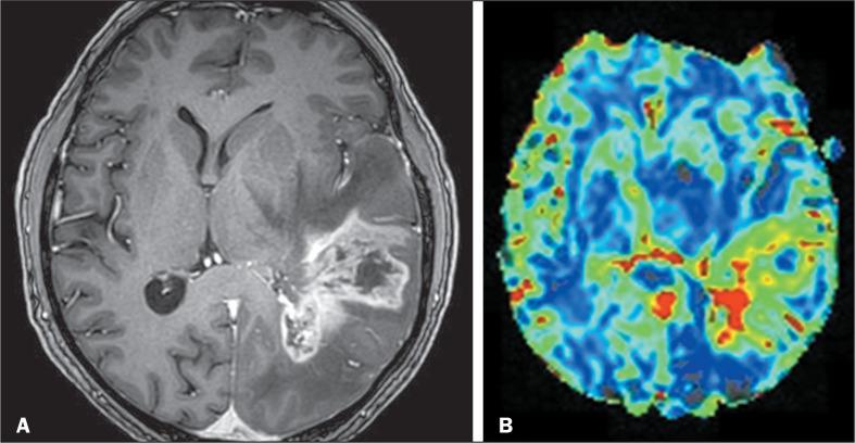 https://cdn.ncbi.nlm.nih.gov/pmc/blobs/4707/11406976/74db870802ea/rb-57-e20240025-g04.jpg