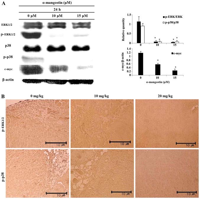 https://cdn.ncbi.nlm.nih.gov/pmc/blobs/4708/4790674/cf12fb35f99f/IJMM-37-04-0939-g05.jpg
