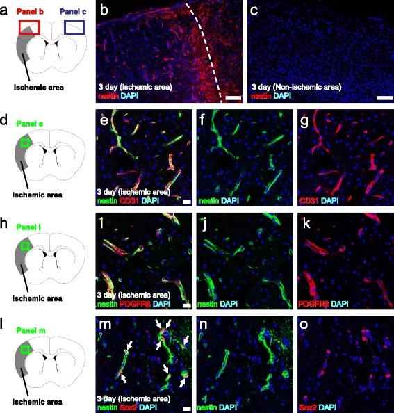 https://cdn.ncbi.nlm.nih.gov/pmc/blobs/470c/4782566/e12831c1e670/12974_2016_523_Fig3_HTML.jpg