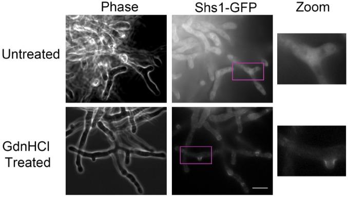 https://cdn.ncbi.nlm.nih.gov/pmc/blobs/470e/7056273/7b985036dd47/elife-54355-fig5.jpg