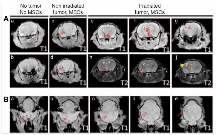 https://cdn.ncbi.nlm.nih.gov/pmc/blobs/470f/11388076/309ad61ce465/thnov14p5022g011.jpg