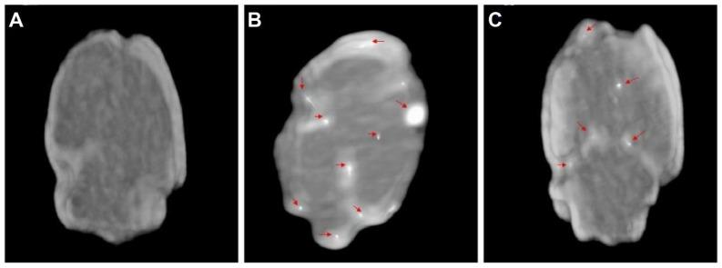 https://cdn.ncbi.nlm.nih.gov/pmc/blobs/470f/11388076/b2be4c5d41e7/thnov14p5022g013.jpg