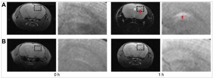 https://cdn.ncbi.nlm.nih.gov/pmc/blobs/470f/11388076/e0dc798a8e71/thnov14p5022g010.jpg