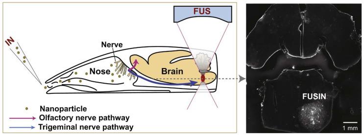https://cdn.ncbi.nlm.nih.gov/pmc/blobs/470f/11388076/fc5baa65e402/thnov14p5022g012.jpg