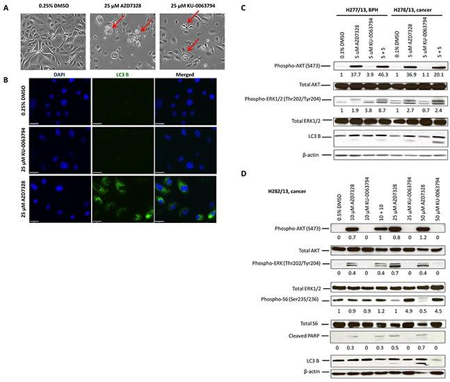 https://cdn.ncbi.nlm.nih.gov/pmc/blobs/4716/5593594/a53138d7b7e7/oncotarget-08-56698-g003.jpg