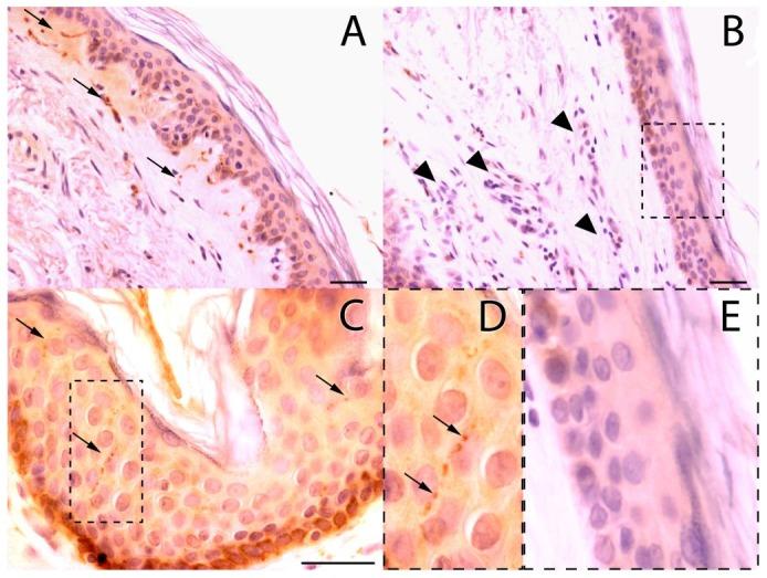https://cdn.ncbi.nlm.nih.gov/pmc/blobs/472c/3521713/1e9e6ce9b78d/pntd.0001975.g002.jpg
