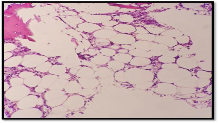 https://cdn.ncbi.nlm.nih.gov/pmc/blobs/472f/8723724/879bf6a52eaf/cureus-0013-00000020135-i01.jpg