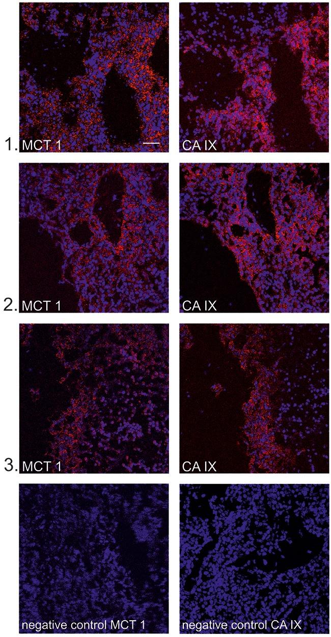https://cdn.ncbi.nlm.nih.gov/pmc/blobs/4734/5652817/6b7d85d16c7c/oncotarget-08-77819-g006.jpg
