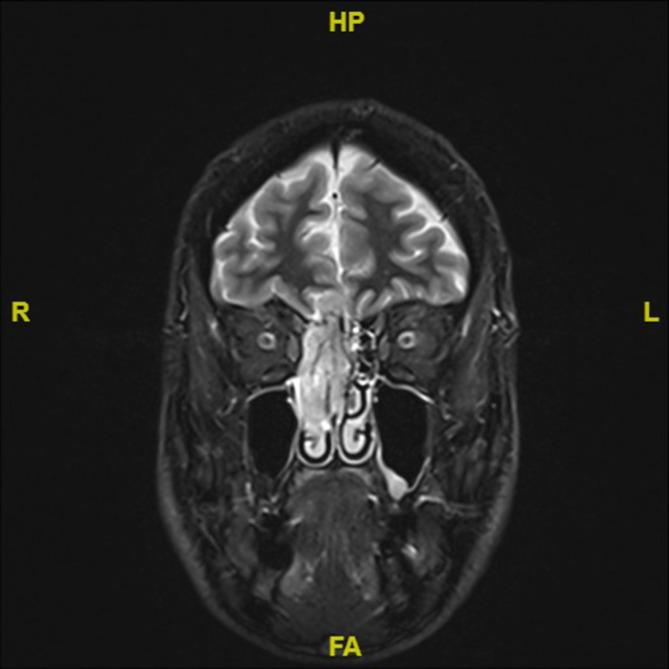 https://cdn.ncbi.nlm.nih.gov/pmc/blobs/4735/10959777/8cf7586152fa/106_2024_1438_Fig1_HTML.jpg