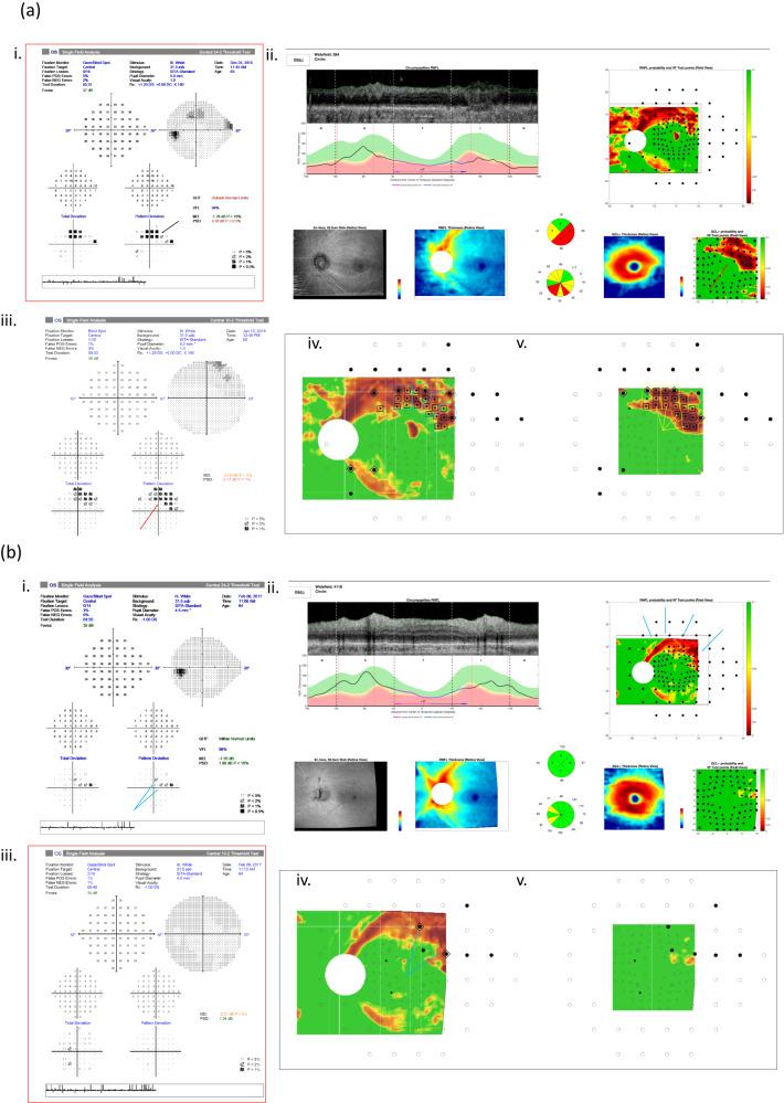 https://cdn.ncbi.nlm.nih.gov/pmc/blobs/473e/10764715/edd5a2fa6a16/41433_2023_2650_Fig3_HTML.jpg