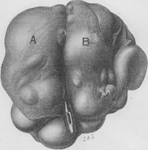 https://cdn.ncbi.nlm.nih.gov/pmc/blobs/473e/2353774/32e91eb90ba8/brmedj08170-0009-a.jpg