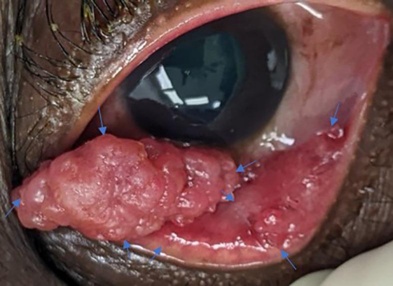 https://cdn.ncbi.nlm.nih.gov/pmc/blobs/4740/10113069/0ca64dd9e231/atm-11-06-266-f2.jpg