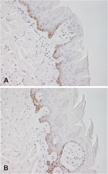 https://cdn.ncbi.nlm.nih.gov/pmc/blobs/4740/4237775/df27b84a62ee/s12929-014-0082-2-3.jpg