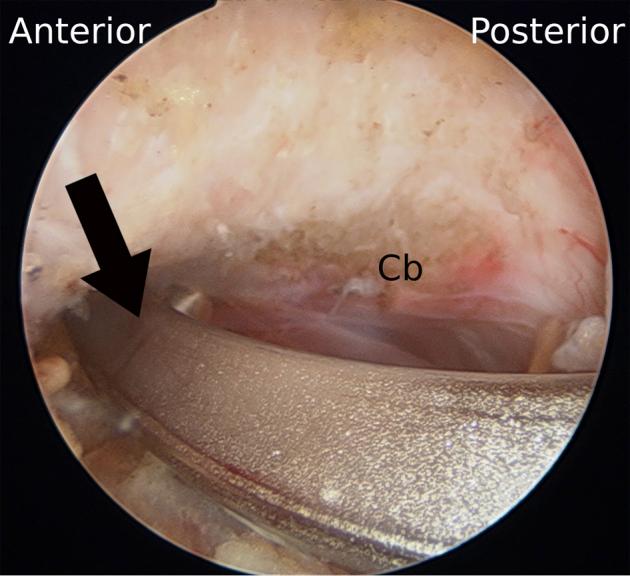 https://cdn.ncbi.nlm.nih.gov/pmc/blobs/4748/7917010/3e48649190b1/gr4.jpg