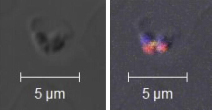 https://cdn.ncbi.nlm.nih.gov/pmc/blobs/4754/3377962/7847ccbbe3d6/fx1.jpg