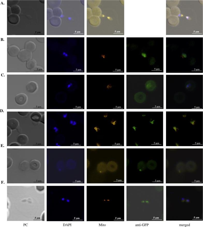 https://cdn.ncbi.nlm.nih.gov/pmc/blobs/4754/3377962/bb8ee07d9fb6/gr3.jpg
